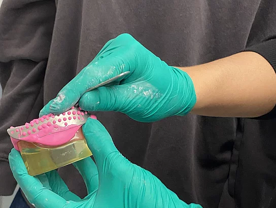 Zahnkronen schleifen im Haus der Zahngesundheit